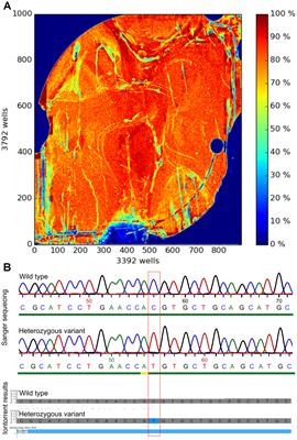 Development of an AmpliSeqTM Panel for Next-Generation Sequencing of a Set of Genetic Predictors of Persisting Pain